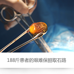 example-image